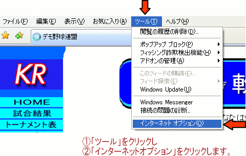 キャッシュのクリア、インターネット一時ファイル削除1